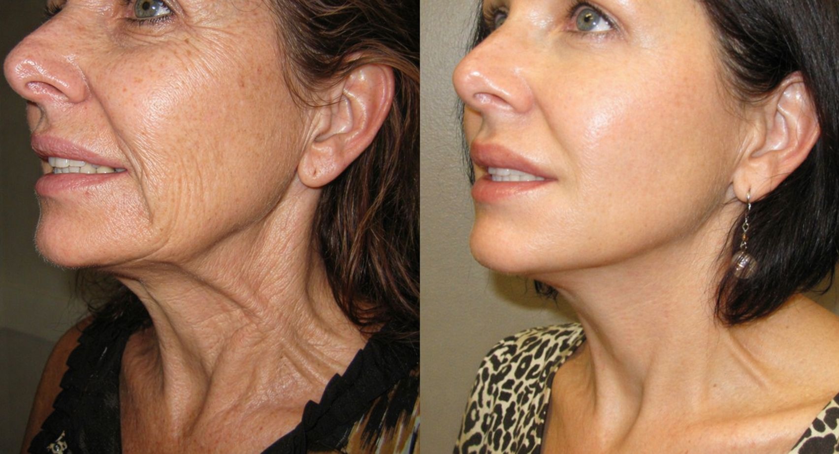 Best Gentle Wrinkle-Fighting Products 2026